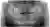 A panoramic dental radiograph showing a complete upper and lower arch of teeth with both jaw joints and the surrounding bone, and no visible restorations.